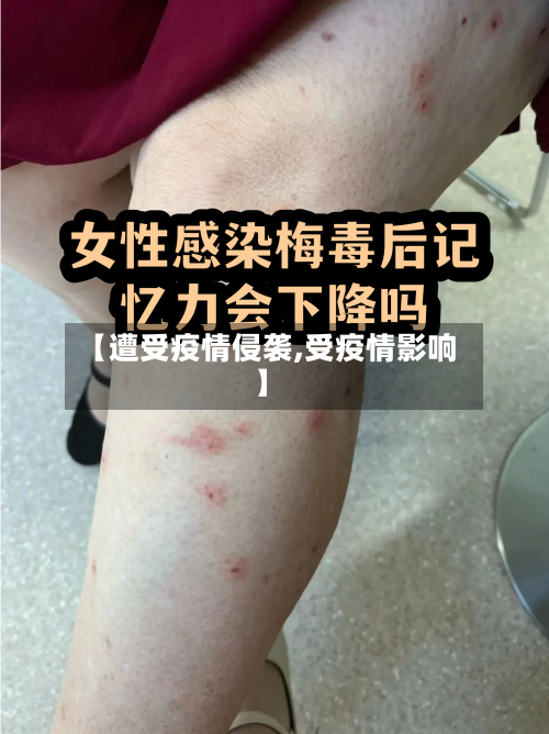 【遭受疫情侵袭,受疫情影响】