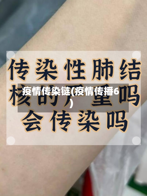 疫情传染链(疫情传播6)
