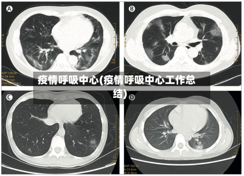 疫情呼吸中心(疫情呼吸中心工作总结)-第3张图片