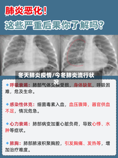 冬天肺炎疫情/今冬肺炎流行状况-第2张图片