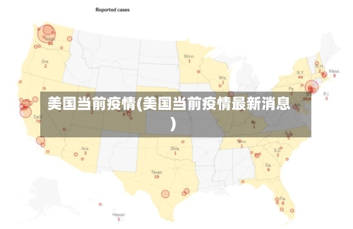 美国当前疫情(美国当前疫情最新消息)