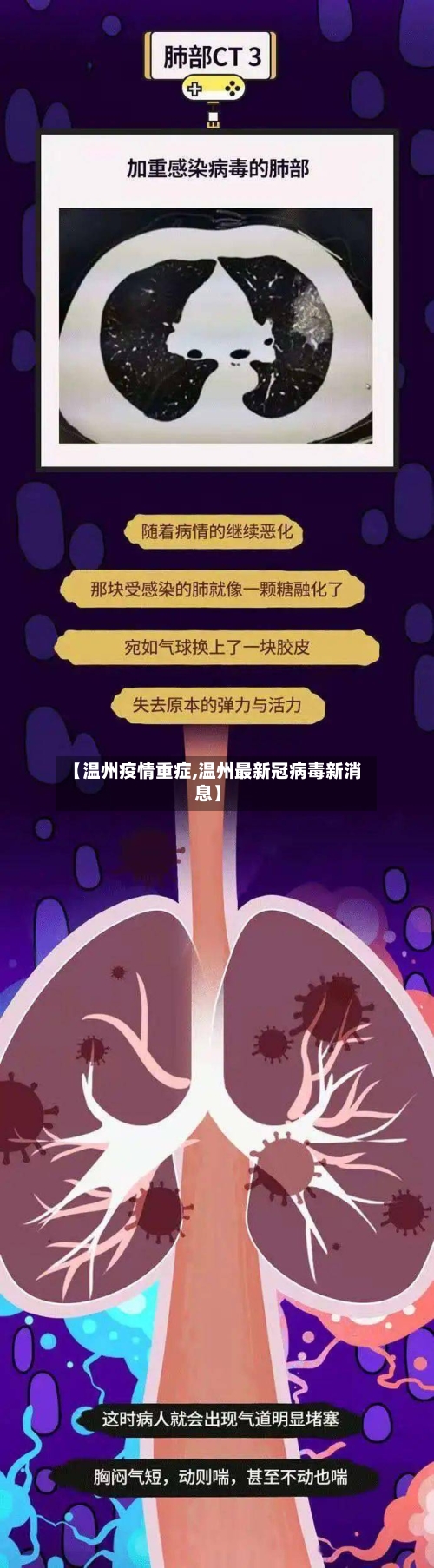 【温州疫情重症,温州最新冠病毒新消息】