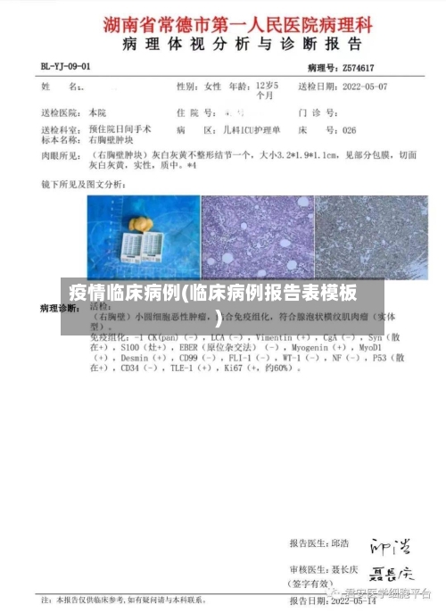 疫情临床病例(临床病例报告表模板)-第2张图片
