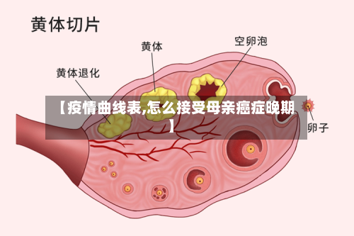 【疫情曲线表,怎么接受母亲癌症晚期】