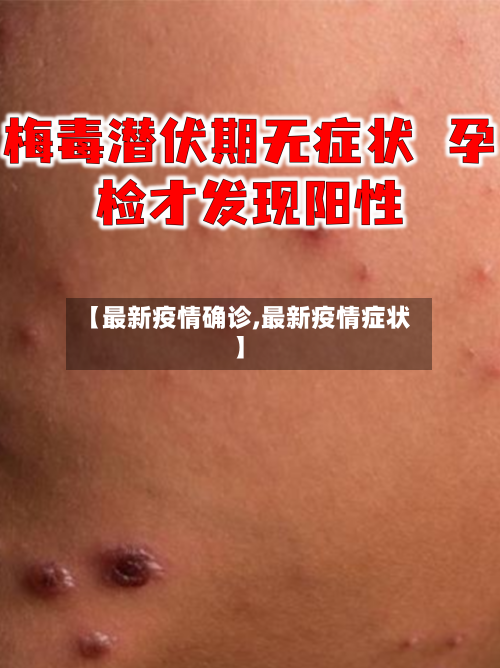 【最新疫情确诊,最新疫情症状】