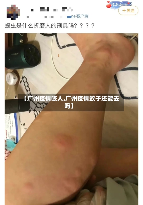 【广州疫情咬人,广州疫情蚊子还能去吗】-第2张图片