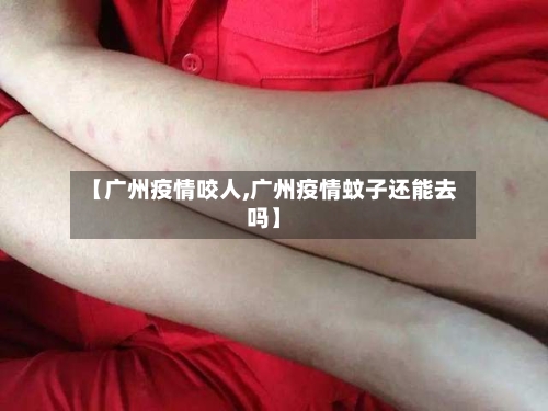 【广州疫情咬人,广州疫情蚊子还能去吗】-第3张图片